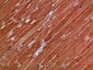 TTN Polyclonal Antibody